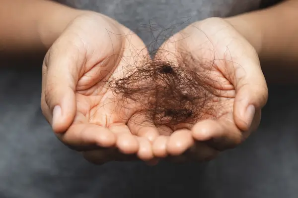 Alopecia: Compreenda as Causas e Encontre Soluções para a Queda de Cabelo